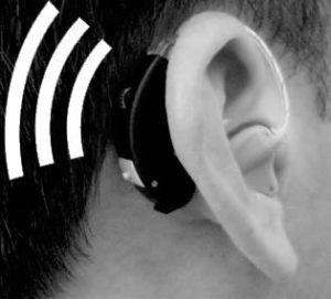 What Is Tinnitus Retaining Therapy for Misophonia?